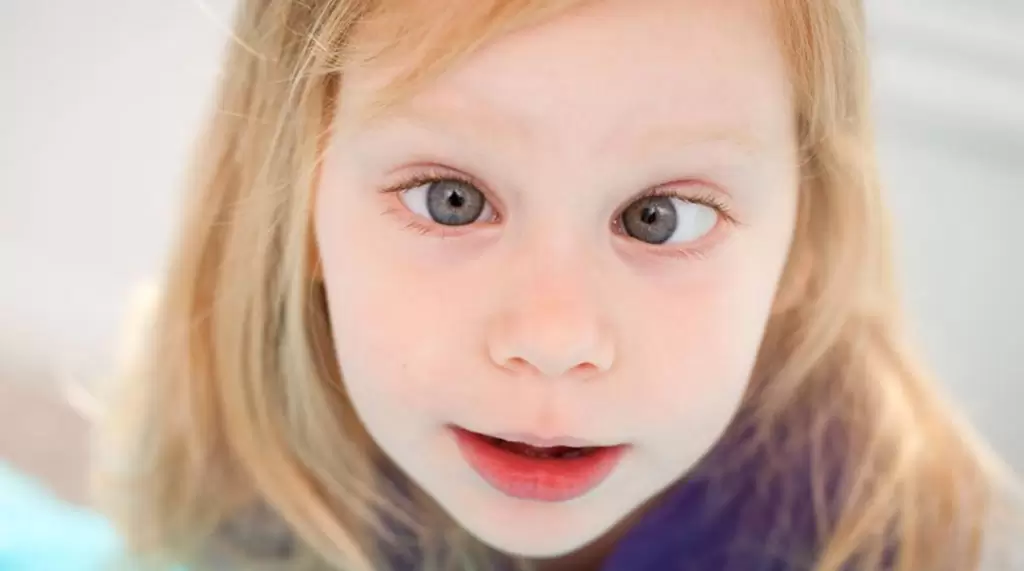 Strabismus Operations