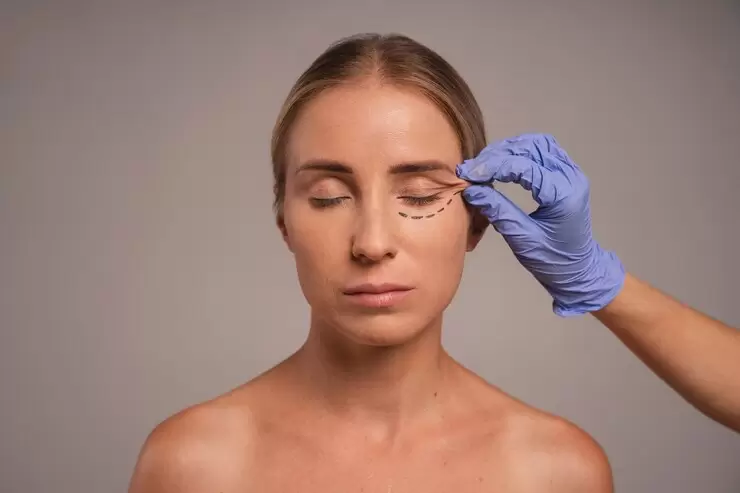 Rejuvenate your eyes with a blepharoplasty procedure. Ideal for aesthetic eye health.